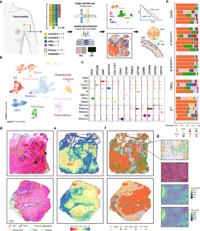 Nat Commun（IF:15.7）：人类乳腺癌空间精细图谱：找到控制免疫细胞进入肿瘤的“小血管关卡”